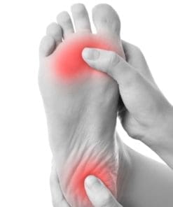 Plantar Fasciitis