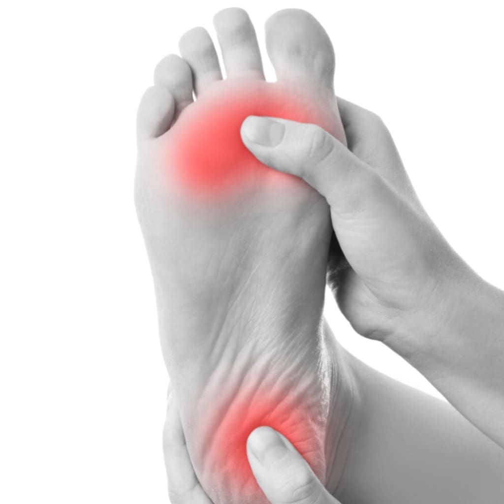Plantar Fasciitis