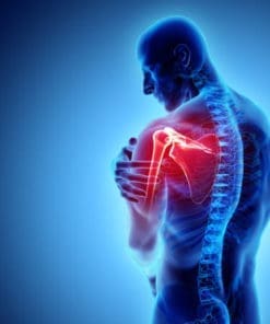 Shoulder Instability